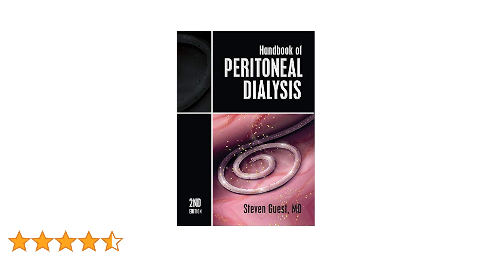 Amazon.co.jp: Handbook of Peritoneal Dialysis: Second